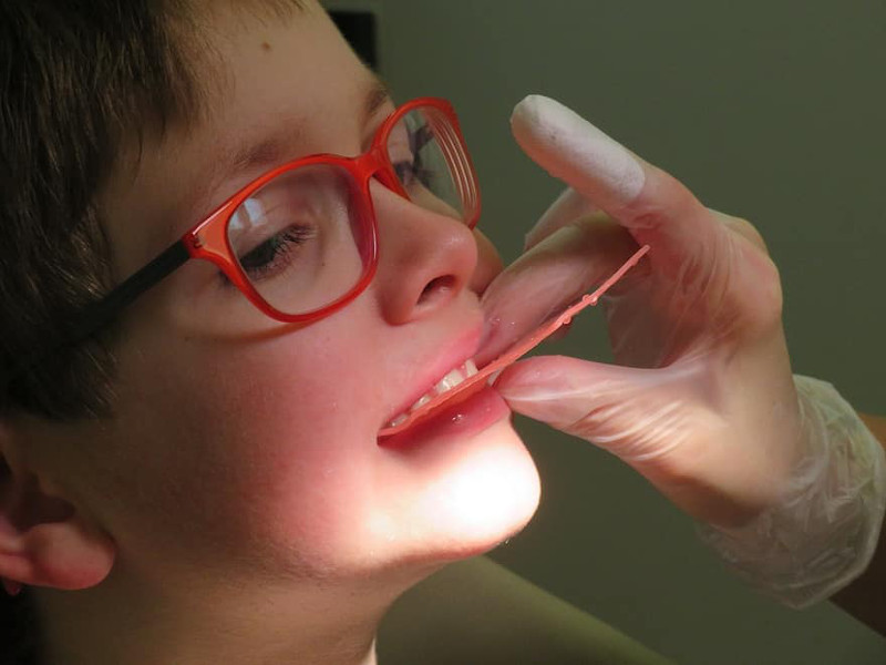 A young boy in red glasses having his teeth and jaw alignment examined by an orthodontist.