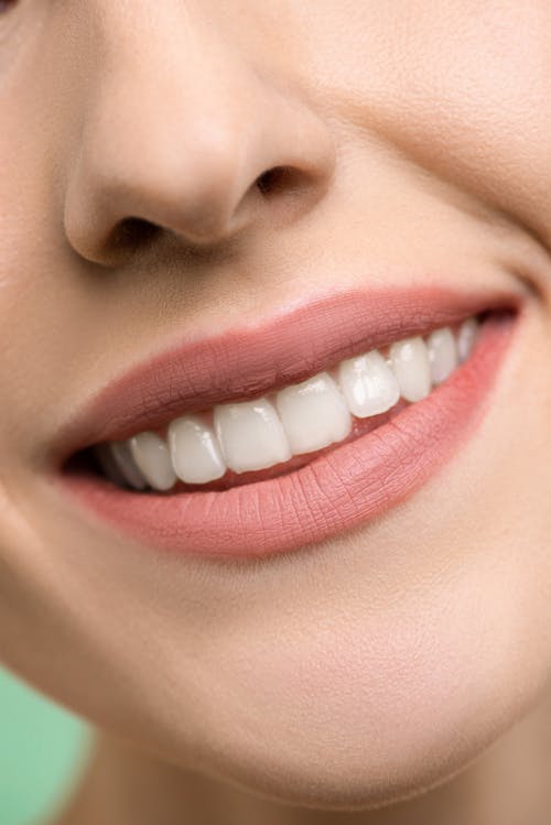 A close-up image of a person’s smile.